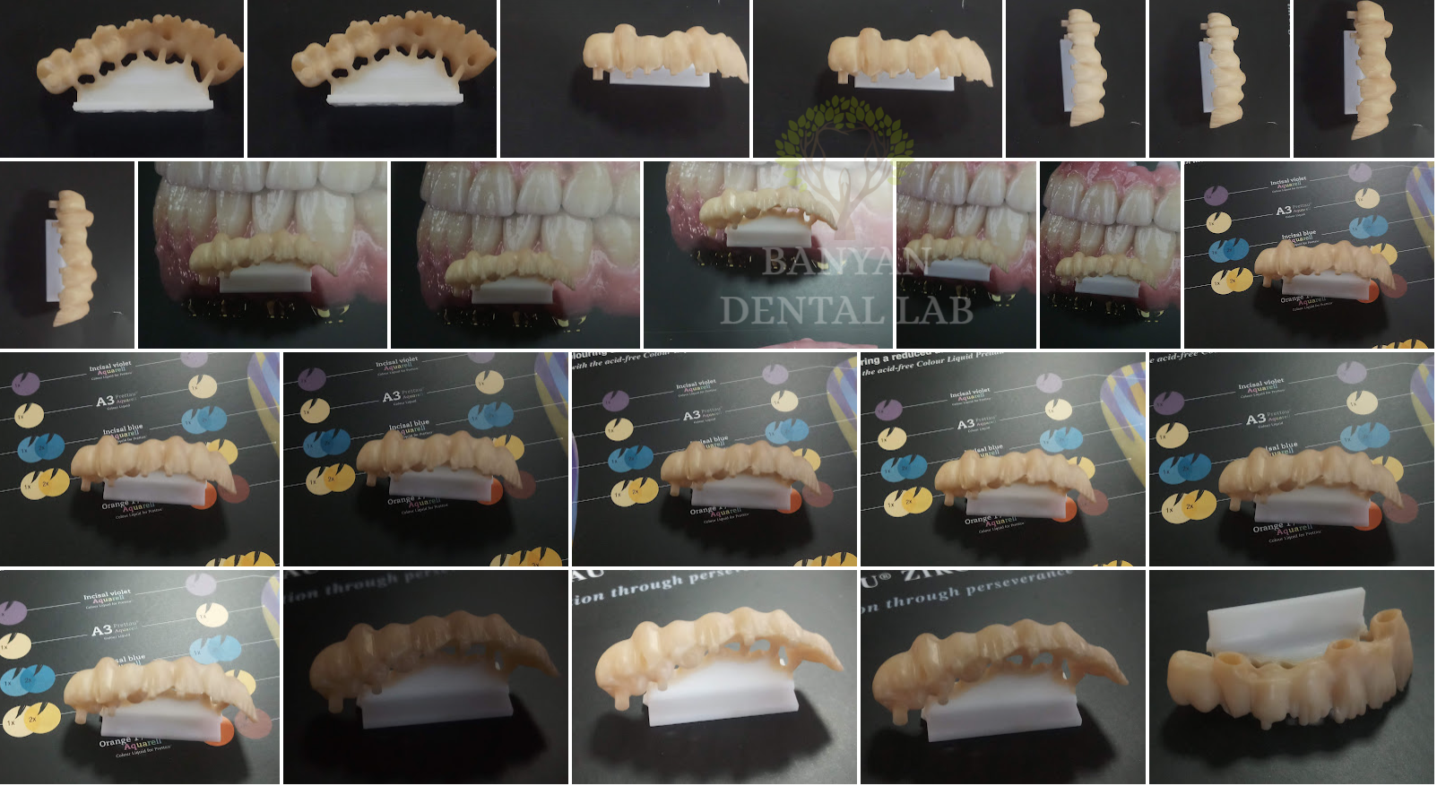 Banyan Dental Lab